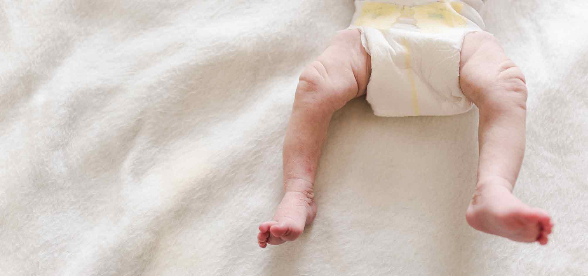Diaper rash: everything you need to know