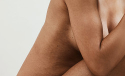 Bladder control basics and incontinence
