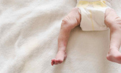 Diaper rash: everything you need to know
