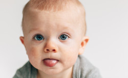 What is tongue-tie and how to manage it