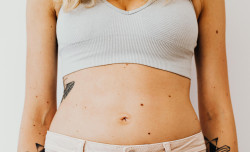 I would end up in A&E because I assumed something was really wrong”: 2 women on the realities of living with endometriosis